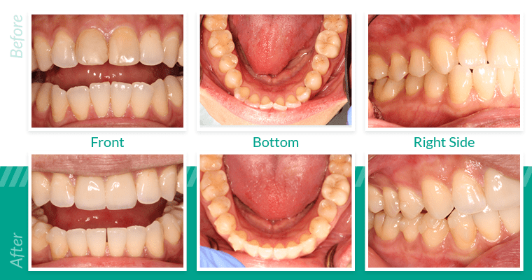 Images of before and after dental work